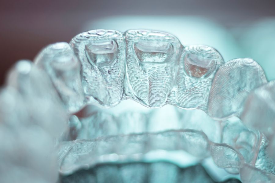 primer plano de la ortodoncia invisible