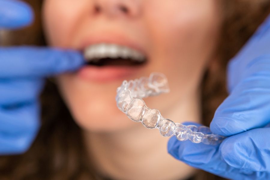 dentista muestra una ortodoncia invisible Invisalign mientras abre el lateral de la boca de una paciente